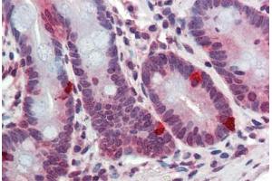 Human Small Intestine: Formalin-Fixed, Paraffin-Embedded (FFPE) (ARL2 Antikörper  (AA 123-184))