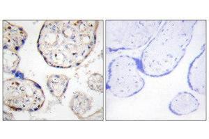 Immunohistochemistry (IHC) image for anti-STEAP Family Member 4 (STEAP4) (Internal Region) antibody (ABIN1849702) (STEAP4 Antikörper  (Internal Region))
