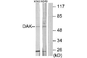 Western blot analysis of extracts from K562 cells and A549 cells, using DAK antibody.