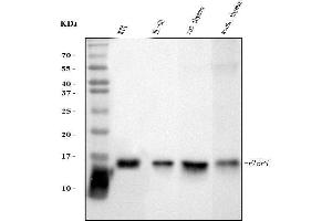 Western blot analysis of FABP4 using anti-FABP4 antibody (ABIN7603145).