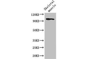 Western Blot Positive WB detected in: Mouse skeletal muscle tissue All lanes: SLFN11 antibody at 2. (SLFN11 Antikörper  (AA 670-821))