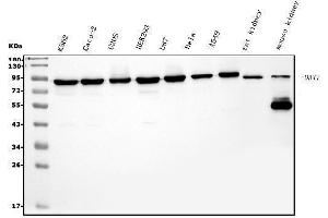 Western blot analysis of DDX1 using anti-DDX1 antibody (ABIN7602051).