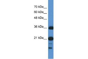 WB Suggested Anti-C1orf144  Antibody Titration: 0. (C1orf144 Antikörper  (N-Term))