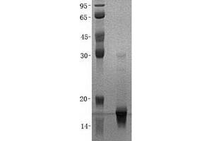 Validation with Western Blot (CUTA Protein (Transcript Variant 1) (His tag))