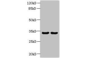 Western blot All lanes: ROGDI antibody at 1. (ROGDI Antikörper  (AA 14-287))