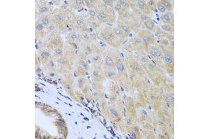 Immunohistochemistry of paraffin-embedded human liver using IL5 antibody (ABIN5975164) at dilution of 1/100 (40x lens). (IL-5 Antikörper)