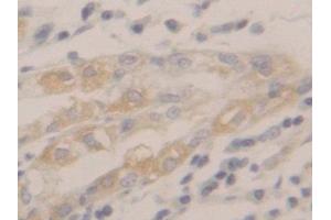 IHC-P analysis of Human Stomach Tissue, with DAB staining. (Peroxiredoxin 2 Antikörper  (AA 6-164))