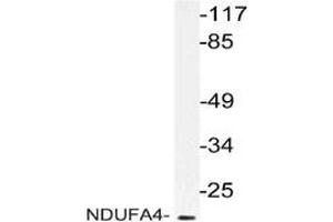 Western blot: analysis of NDUFA4 antibody staining in extracts from RAW264. (NDUFA4 Antikörper)
