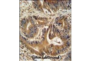 Immunohistochemistry (Paraffin-embedded Sections) (IHC (p)) image for anti-Vacuolar Protein Sorting 52 Homolog (VPS52) (AA 610-637), (C-Term) antibody (ABIN654879)