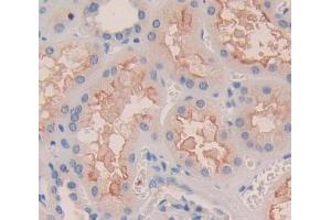 Used in DAB staining on fromalin fixed paraffin- embedded Kidney tissue (ITGA8 Antikörper  (AA 907-1063))