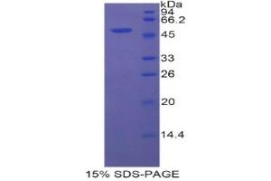 SDS-PAGE analysis of Rat FSIP1 Protein. (FSIP1 Protein)