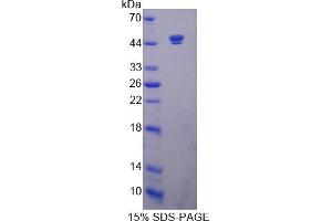 Image no. 1 for Sirtuin 7 (SIRT7) (AA 1-400) protein (His tag) (ABIN4990330) (SIRT7 Protein (AA 1-400) (His tag))