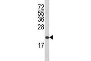 Western Blotting (WB) image for anti-TNF Receptor Superfamily, Member 6 (FAS) (AA 185-211) antibody (ABIN3030902)