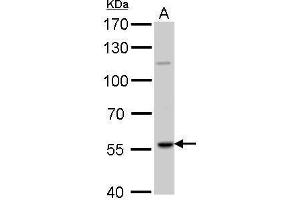 WB Image RAG2 antibody detects RAG2 protein by Western blot analysis. (RAG2 Antikörper  (Center))