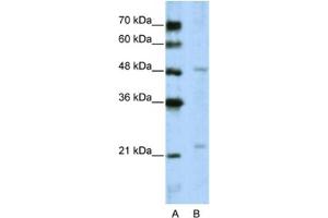 Western Blotting (WB) image for anti-WD Repeat Domain 12 (WDR12) antibody (ABIN2462386) (WDR12 Antikörper)