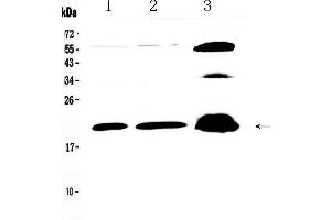 CPI-17 Antikörper  (AA 30-126)