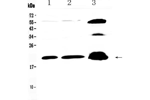 CPI-17 antibody  (AA 30-126)
