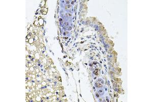 Immunohistochemistry of paraffin-embedded mouse lung using RHOT1 antibody (ABIN5973450) at dilution of 1/100 (40x lens). (RHOT1 Antikörper)