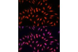 Immunofluorescence analysis of U-2 OS cells using KLHL8 antibody (ABIN7268081) at dilution of 1:100. (KLHL8 Antikörper  (AA 271-620))