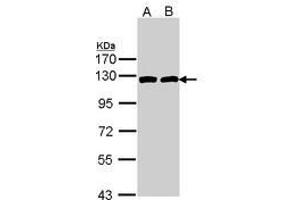 Image no. 1 for anti-ATP Citrate Lyase (ACLY) (AA 793-1008) antibody (ABIN467566) (ACLY Antikörper  (AA 793-1008))
