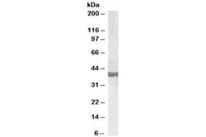 Western blot testing of human frontal cortex lysate with SH3GL2 antibody at 0.