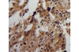 Used in DAB staining on fromalin fixed paraffin-embedded ovary tissue (PPIA Antikörper  (AA 2-164))