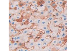 Used in DAB staining on fromalin fixed paraffin- embedded Kidney tissue (NAPA Antikörper  (AA 1-295))