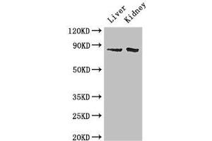 Western Blot Positive WB detected in: Mouse liver tissue, Mouse kidney tissue All lanes: SMO antibody at 2 μg/mL Secondary Goat polyclonal to rabbit IgG at 1/50000 dilution Predicted band size: 87 kDa Observed band size: 87 kDa (SMO Antikörper  (AA 28-233))