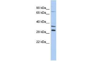 WB Suggested Anti-TSGA13 Antibody Titration: 0.