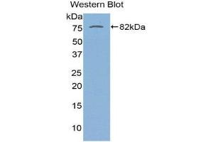 Western Blotting (WB) image for anti-serpin Peptidase Inhibitor, Clade A (Alpha-1 Antiproteinase, Antitrypsin), Member 10 (SERPINA10) (AA 22-448) antibody (ABIN1863312)