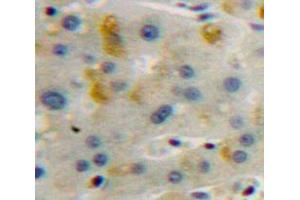 Used in DAB staining on fromalin fixed paraffin-embedded Liver tissue (LAMP2 Antikörper  (AA 29-192))