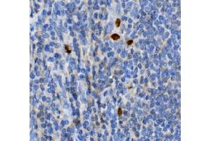 IHC analysis of JUNB using anti-JUNB antibody (ABIN7601187).