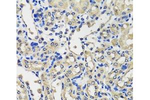 Immunohistochemistry of paraffin-embedded Mouse kidney using SCG3 Polyclonal Antibody at dilution of 1:100 (40x lens). (SCG3 Antikörper)