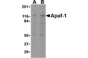 Western Blotting (WB) image for anti-Apoptotic Peptidase Activating Factor 1 (APAF1) antibody (ABIN1031715) (APAF1 Antikörper)