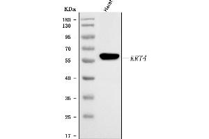 Western blot analysis of Cytokeratin 4/KRT4 using anti-Cytokeratin 4/KRT4 antibody (ABIN7600283).