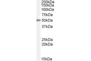 Western Blotting (WB) image for anti-EF-Hand Domain Family, Member B (EFHB) (C-Term) antibody (ABIN2785078) (EFHB Antikörper  (C-Term))