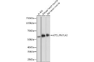 Western blot analysis of extracts of various cell lines, using ATGL/PNPL antibody (ABIN7269183) at 1:1000 dilution. (PNPLA2 Antikörper)