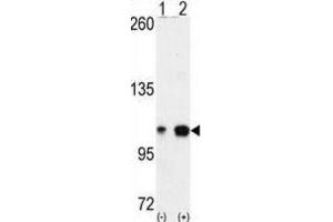 Western Blotting (WB) image for anti-EPH Receptor A4 (EPHA4) antibody (ABIN2927880)