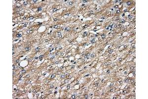 Immunohistochemical staining of paraffin-embedded prostate tissue using anti-CAPZA1 mouse monoclonal antibody. (CAPZA1 Antikörper)