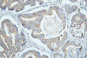 IHC analysis of PDCD6IP using anti-PDCD6IP antibody (ABIN7600490). (ALIX Antikörper  (AA 2-330))