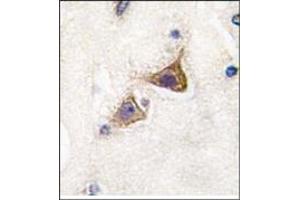 Image no. 2 for anti-Junctophilin 3 (JPH3) (Middle Region) antibody (ABIN357848) (Junctophilin 3 Antikörper  (Middle Region))