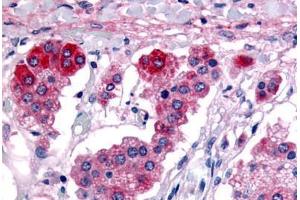 Human Adrenal (formalin-fixed, paraffin-embedded) stained with GPR182 antibody ABIN213455 at 6-9 ug/ml followed by biotinylated goat anti-rabbit IgG secondary antibody ABIN481713, alkaline phosphatase-streptavidin and chromogen. (G Protein-Coupled Receptor 182 Antikörper  (C-Term))