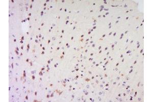 Formalin-fixed and paraffin embedded rat brain labeled with Anti-EXOSC7 Polyclonal Antibody, Unconjugated  at 1:200 followed by conjugation to the secondary antibody and DAB staining. (EXOSC7 Antikörper  (AA 21-120))