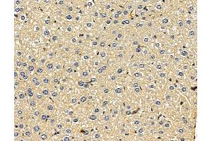 ABIN7096454 and ABIN7100518 at 1/100 staining mouse liver tissue by IHC-P. (UGT2B28 Antikörper)
