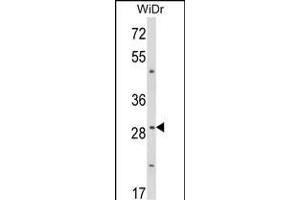 Western blot analysis of ZFP36 Antibody (Center) (ABIN652899 and ABIN2842580) in WiDr cell line lysates (35 μg/lane). (ZFP36 Antikörper  (AA 116-142))