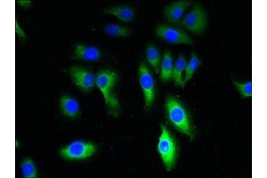 Immunofluorescent analysis of A549 cells using ABIN7172870 at dilution of 1:100 and Alexa Fluor 488-congugated AffiniPure Goat Anti-Rabbit IgG(H+L) (TRPM8 Antikörper  (AA 1-192))