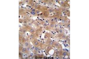 Immunohistochemistry (IHC) image for anti-Transient Receptor Potential Cation Channel, Subfamily M, Member 8 (TRPM8) antibody (ABIN2996363) (TRPM8 Antikörper)