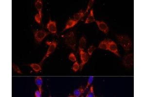 Immunofluorescence analysis of NIH/3T3 cells using DVL2 Polyclonal Antibody at dilution of 1:100. (DVL2 Antikörper)