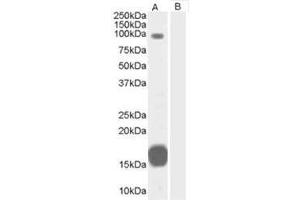Image no. 1 for anti-rho GTPase Activating Protein 26 (ARHGAP26) (C-Term) antibody (ABIN374371) (GRAF Antikörper  (C-Term))
