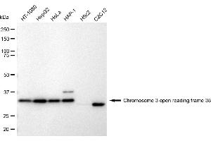 Western blotting analysis using Chromosome 3 open reading frame 38 antibody (ABIN7798079). (Rekombinanter C3orf38 Antikörper)